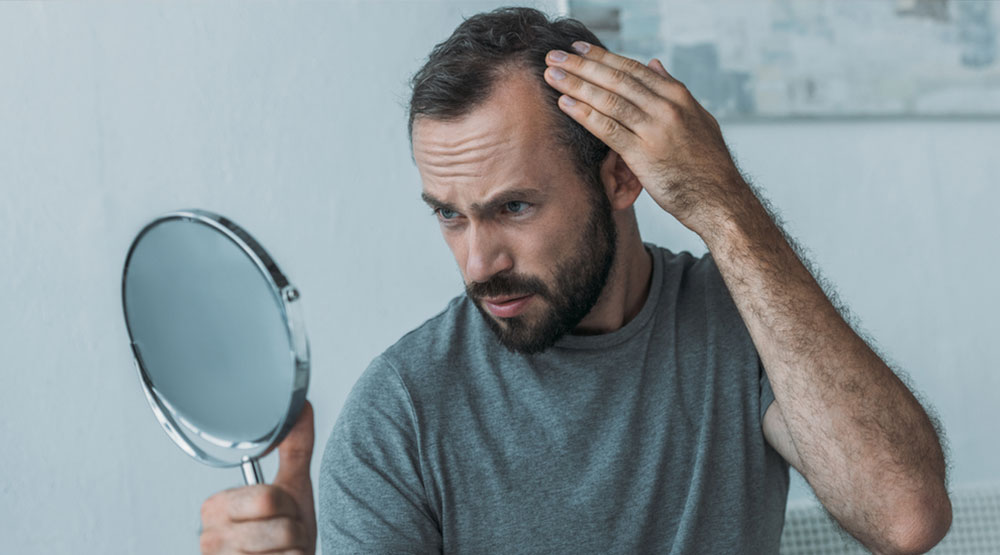 ¡Actúa a tiempo! Entradas en la línea del cabello pronunciadas